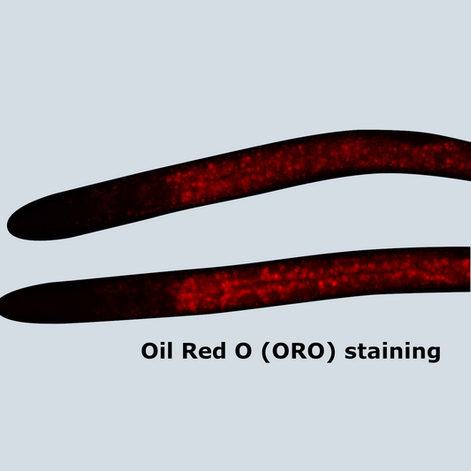 Lipid Accumulation Assay